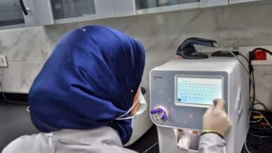 هيئة الرعاية الصحية: 18 زراعة كُلى بمركز 30 يونيو الدولي لأمراض الكُلى والمسالك بنسب نجاح عالمية