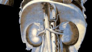 عادات شائعة تتلف الكلى بصمت