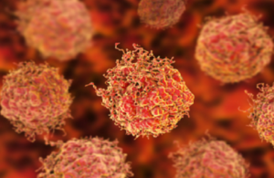 دراسة إماراتية: دواء شائع للكوليسترول قد يطيل عمر مرضى سرطان الدم