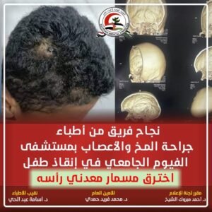مصر.. نجاح فريق أطباء جراحة المخ والأعصاب من إنقاذ طفل اخترق مسمار معدني رأس