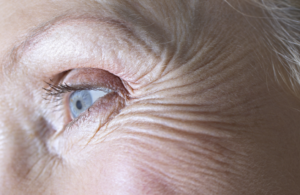 فيتامين أساسي يحارب التجاعيد والبقع الداكنة