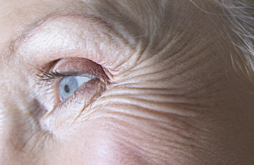 فيتامين أساسي يحارب التجاعيد والبقع الداكنة