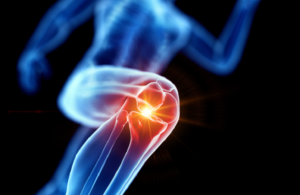 خيوط ذهبية" في ركبتي امرأة كورية تربك الأطباء!